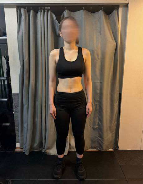 41才／女性 ビフォー｜骨格矯正とトレーニング前の状態