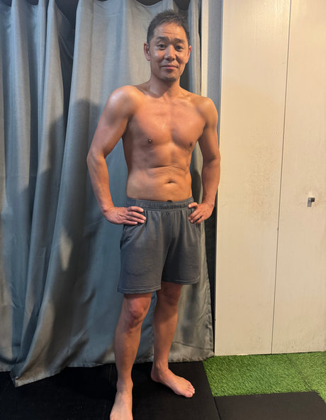 47才／男性 アフター｜2ヶ月での変化