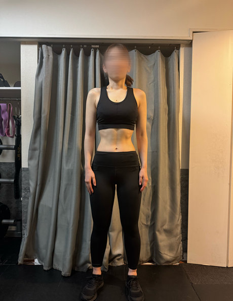 41才／女性 アフター｜3ヶ月での変化